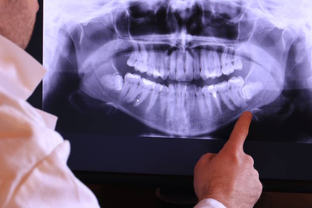 Best Pediatric Emergency Dentist in Lake Lakengren, OH